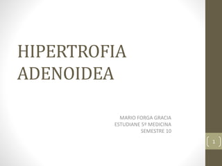 HIPERTROFIA
ADENOIDEA
MARIO FORGA GRACIA
ESTUDIANE 5º MEDICINA
SEMESTRE 10
1
 