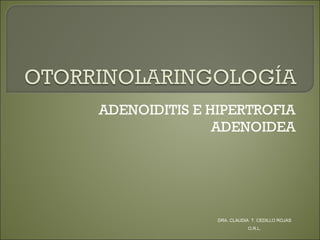 ADENOIDITIS E HIPERTROFIA
ADENOIDEA
DRA. CLAUDIA T. CEDILLO ROJAS
O.R.L.
 