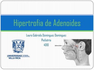 Laura Gabriela Domínguez Domínguez
Pediatría
4010
Hipertrofia de Adenoides
 