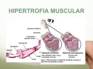 HIPERTROFIA MUSCULAR 
 