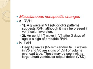 Hipertrofias ventriculares | PPTX