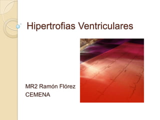 Hipertrofias Ventriculares




MR2 Ramón Flórez
CEMENA
 