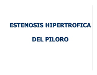 ESTENOSIS HIPERTROFICAESTENOSIS HIPERTROFICA
DEL PILORODEL PILORO
 