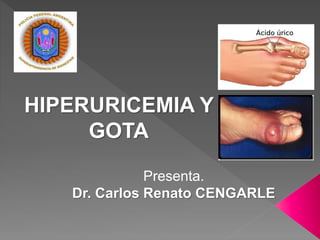 Presenta.
Dr. Carlos Renato CENGARLE
HIPERURICEMIA Y
GOTA
 