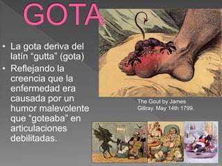• La gota deriva del
latín “gutta” (gota)
• Reflejando la
creencia que la
enfermedad era
causada por un
humor malevolente
que “goteaba” en
articulaciones
debilitadas.
The Gout by James
Gillray. May 14th 1799.
 