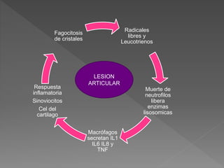 Radicales
libres y
Leucotrienos
Muerte de
neutrofilos
libera
enzimas
lisosomicas
Macrófagos
secretan IL1
IL6 IL8 y
TNF
Respuesta
inflamatoria
Sinoviocitos
Cel del
cartilago
Fagocitosis
de cristales
LESION
ARTICULAR
 