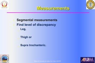 Bahaa Ali Kornah-Al-Azhar Un. Cairo. EGYPT
Measurements
l Segmental measurements
l Find level of discrepancy
_ Leg,
_ Thigh or
_ Supra trochanteric.
 