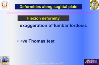 Bahaa Ali Kornah-Al-Azhar Un. Cairo. EGYPT
Deformities along sagittal plain
Flexion deformity
• exaggeration of lumbar lordosis
• +ve Thomas test
 