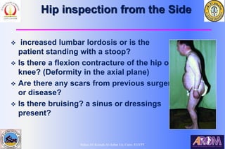 Bahaa Ali Kornah-Al-Azhar Un. Cairo. EGYPT
Hip inspection from the Side
 increased lumbar lordosis or is the
patient standing with a stoop?
 Is there a flexion contracture of the hip or
knee? (Deformity in the axial plane)
 Are there any scars from previous surgery
or disease?
 Is there bruising? a sinus or dressings
present?
 
