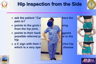 Bahaa Ali Kornah-Al-Azhar Un. Cairo. EGYPT
Hip inspection from the Side
 ask the patient “Can you point to where the
pain is?
 points to the groin it is probably arising
from the hip joint,
 points to their back or buttock it suggests
possible referred pain from the spine to the
hip
 a C sign with their hand over the painful hip
which is a very specific sign for hip disease
 