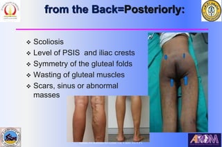 Bahaa Ali Kornah-Al-Azhar Un. Cairo. EGYPT
from the Back=Posteriorly:
 Scoliosis
 Level of PSIS and iliac crests
 Symmetry of the gluteal folds
 Wasting of gluteal muscles
 Scars, sinus or abnormal
masses
 
