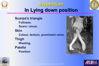 Bahaa Ali Kornah-Al-Azhar Un. Cairo. EGYPT
Inspection
In Lying down position
l Scarpa's triangle
_ Fullness.
_ Scars / sinus.
l Skin
_ Colour, texture, prominent veins.
l Thigh
_ Wasting.
l Patella
_ Position
 