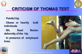 Bahaa Ali Kornah-Al-Azhar Un. Cairo. EGYPT
CRITICISM OF THOMAS TEST
Painful hip
Obese or heavily built
individuals
B/L fixed flexion
deformity of the hip
In presence of ankylosed
knee.
 