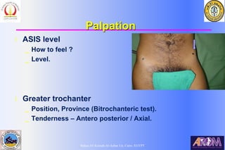 Bahaa Ali Kornah-Al-Azhar Un. Cairo. EGYPT
Palpation
l ASIS level
_ How to feel ?
_ Level.
l Greater trochanter
_ Position, Province (Bitrochanteric test).
_ Tenderness – Antero posterior / Axial.
 