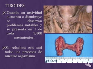 Tiroides.Cuando su actividad aumenta o disminuye se observan problemas notables y se presenta en 1 de cada 3,500 nacimientos.Se relaciona con casi todos los procesos de nuestro organismo