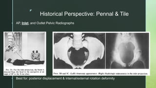 Hip and pelvis for beginners | PPT