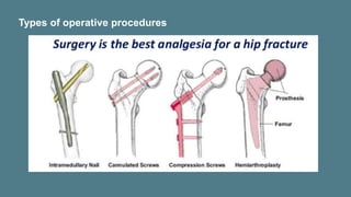 Types of operative procedures
 
