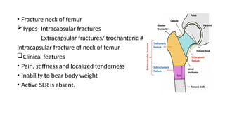 Intracapsular Hip fractures and THR ppt.pptx types of fractures | PPTX