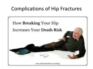 Complications of Hip Fractures
 