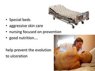 • Special beds
• aggressive skin care
• nursing focused on prevention
• good nutrition….
help prevent the evolution
to ulceration
 