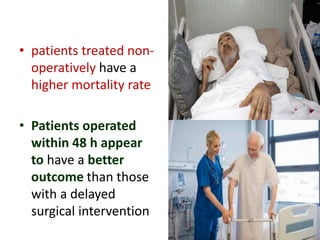 • patients treated non-
operatively have a
higher mortality rate
• Patients operated
within 48 h appear
to have a better
outcome than those
with a delayed
surgical intervention
 