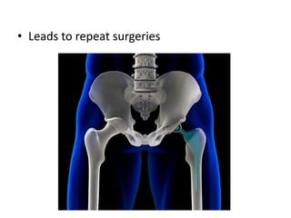 • Leads to repeat surgeries
 