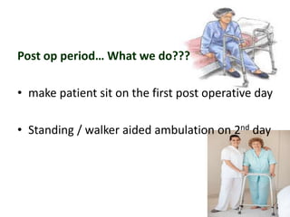 Post op period… What we do???
• make patient sit on the first post operative day
• Standing / walker aided ambulation on 2nd day
 