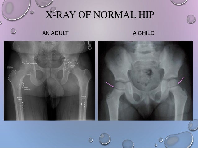 Hip girdle from anatomy to orthopedics