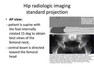 Hip radiologic imaging
standard projection
• AP view:
- patient is supine with
the foot internally
rotated 15 deg to obtain
best views of the
femoral neck;
- central beam is directed
toward the femoral
head
 