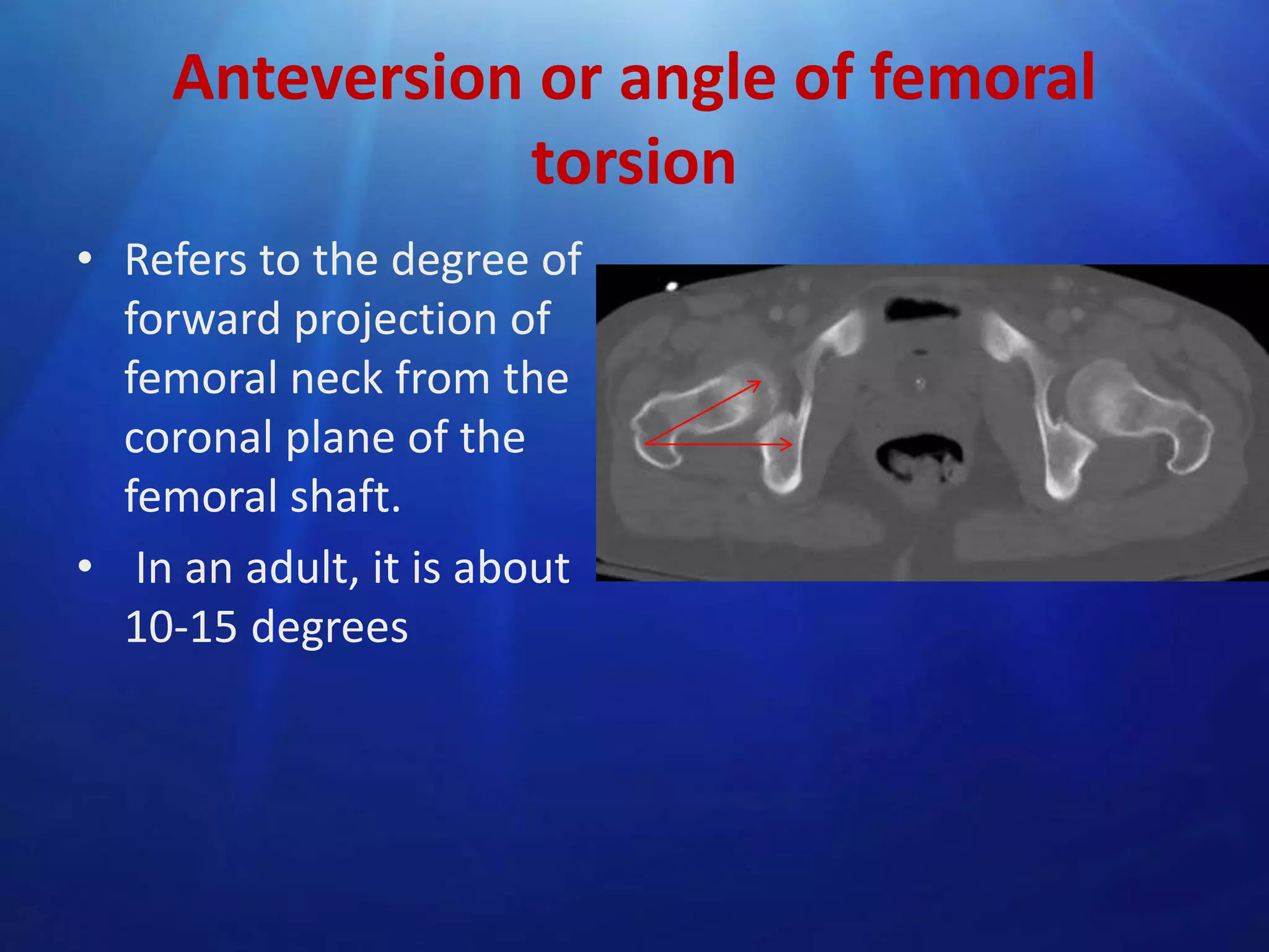Anteversion or angle of femoral
torsion
• Refers to the degree of
forward projection of
femoral neck from the
coronal plane of the
femoral shaft.
• In an adult, it is about
10-15 degrees

 