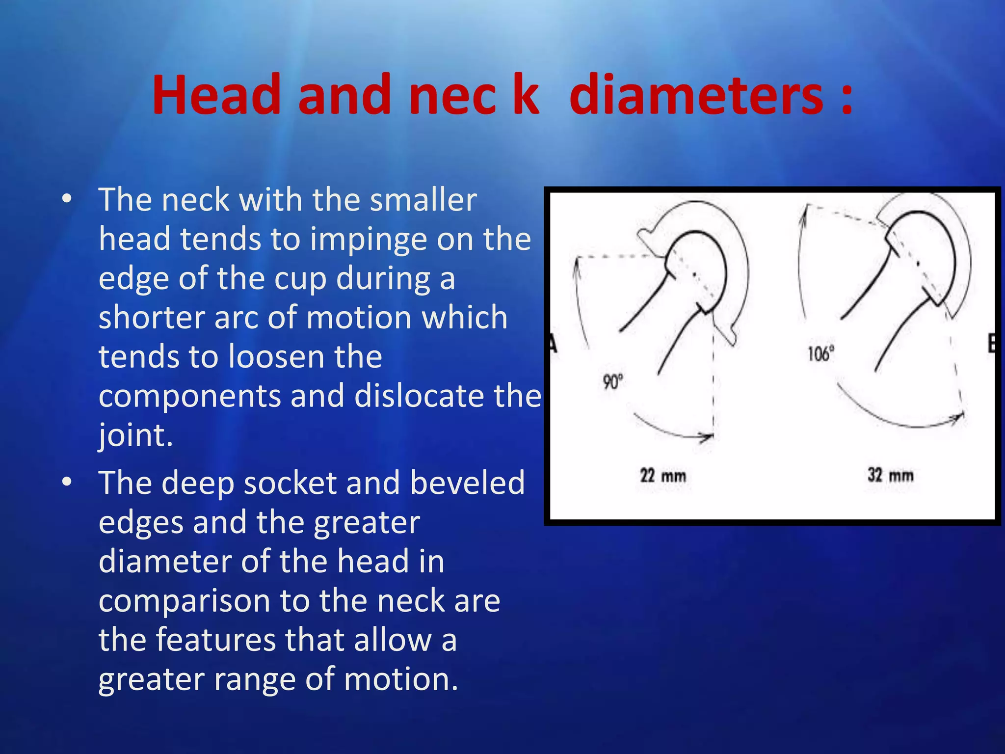 Head and nec k diameters :
• The neck with the smaller
head tends to impinge on the
edge of the cup during a
shorter arc of motion which
tends to loosen the
components and dislocate the
joint.
• The deep socket and beveled
edges and the greater
diameter of the head in
comparison to the neck are
the features that allow a
greater range of motion.

 