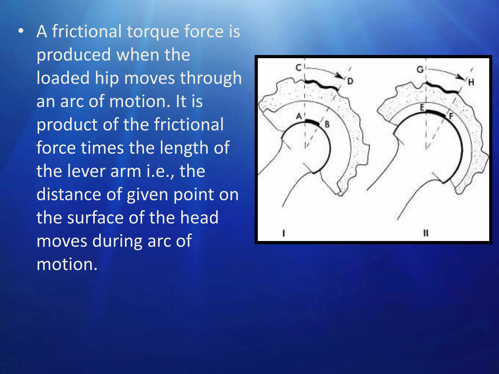 • A frictional torque force is
produced when the
loaded hip moves through
an arc of motion. It is
product of the frictional
force times the length of
the lever arm i.e., the
distance of given point on
the surface of the head
moves during arc of
motion.

 