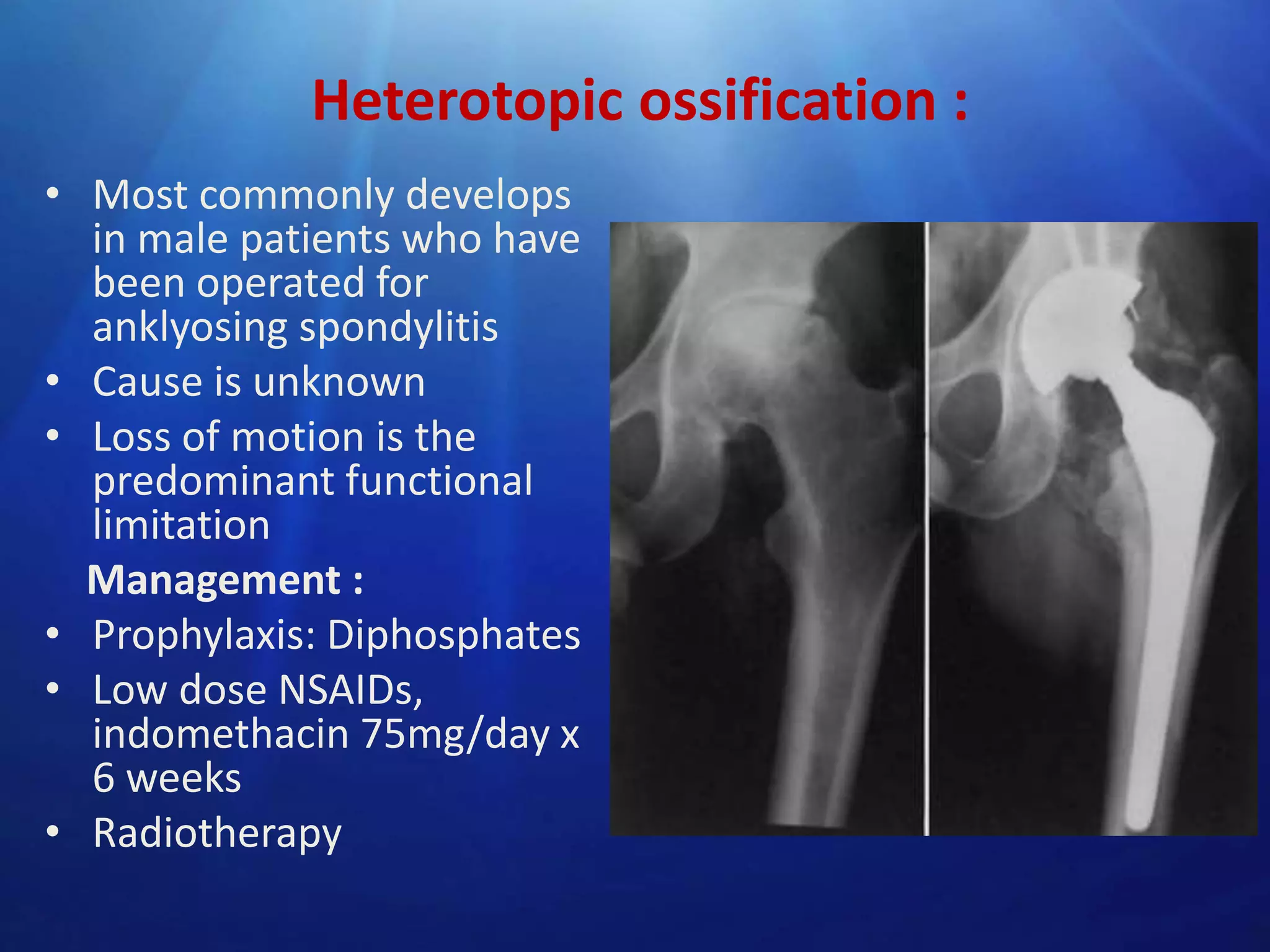 Heterotopic ossification :
• Most commonly develops
in male patients who have
been operated for
anklyosing spondylitis
• Cause is unknown
• Loss of motion is the
predominant functional
limitation
Management :
• Prophylaxis: Diphosphates
• Low dose NSAIDs,
indomethacin 75mg/day x
6 weeks
• Radiotherapy

 