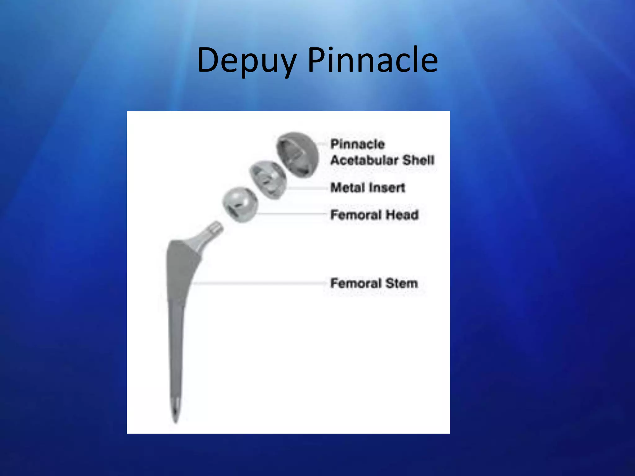 Depuy Pinnacle

 