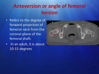 Anteversion or angle of femoral
torsion
• Refers to the degree of
forward projection of
femoral neck from the
coronal plane of the
femoral shaft.
• In an adult, it is about
10-15 degrees

 
