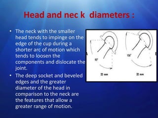 Head and nec k diameters :
• The neck with the smaller
head tends to impinge on the
edge of the cup during a
shorter arc of motion which
tends to loosen the
components and dislocate the
joint.
• The deep socket and beveled
edges and the greater
diameter of the head in
comparison to the neck are
the features that allow a
greater range of motion.

 