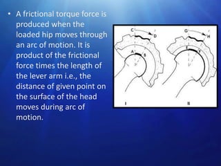 • A frictional torque force is
produced when the
loaded hip moves through
an arc of motion. It is
product of the frictional
force times the length of
the lever arm i.e., the
distance of given point on
the surface of the head
moves during arc of
motion.

 