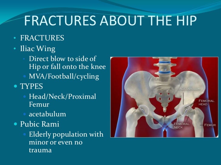 Hip Injuries In The Athelete+Arthroscopy Of The Hip