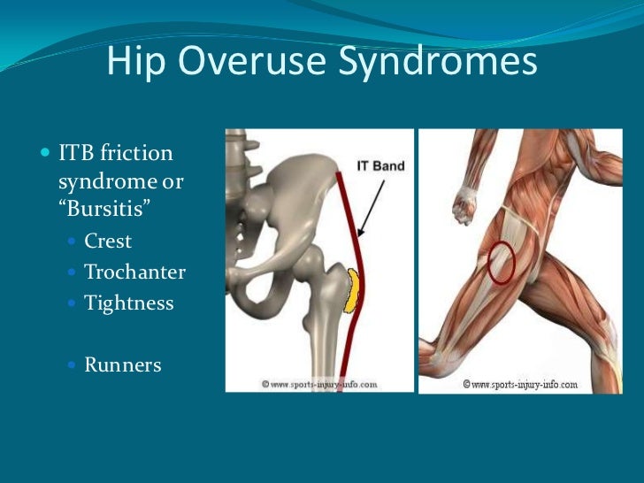Hip Injuries In The Athelete+Arthroscopy Of The Hip