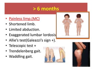 > 6 months
• Painless limp.(MC)
• Shortened limb.
• Limited abduction.
• Exaggerated lumbar lordosis.
• Allie’s test(Galeazzi’s sign +).
• Telescopic test +
• Trendelenberg gait.
• Waddling gait.
 