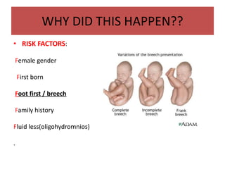 WHY DID THIS HAPPEN??
• RISK FACTORS:
Female gender
First born
Foot first / breech
Family history
Fluid less(oligohydromnios)
.
 