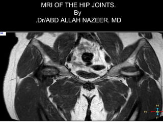 IMAGING OF THE HIP JOINTS.
Dr/ABD ALLAH NAZEER. MD.
 