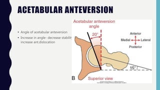 Hip joint | PPTX