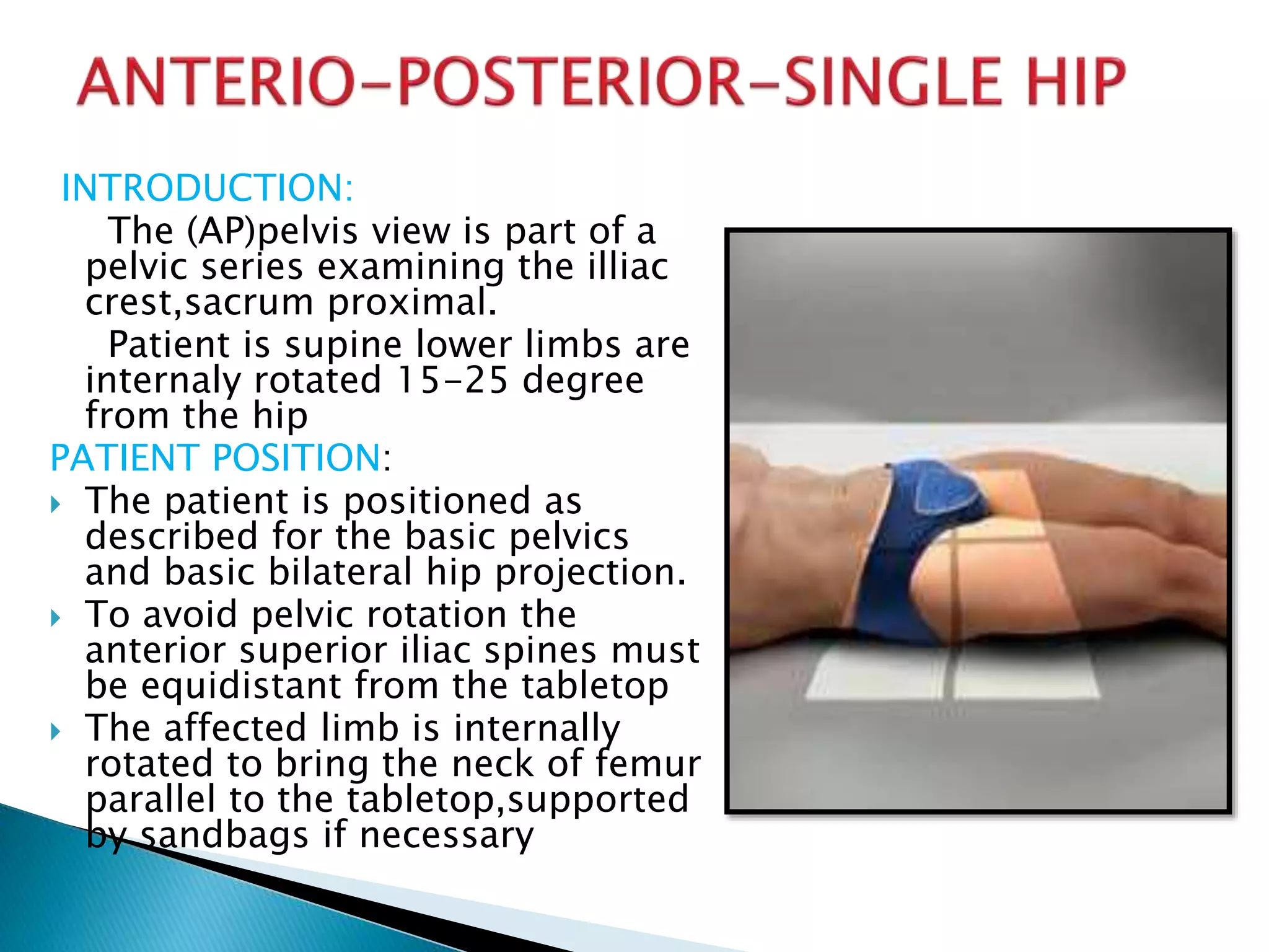 RADIOGRAPHIC VIEWS FOR HIP JOINT | PPTX