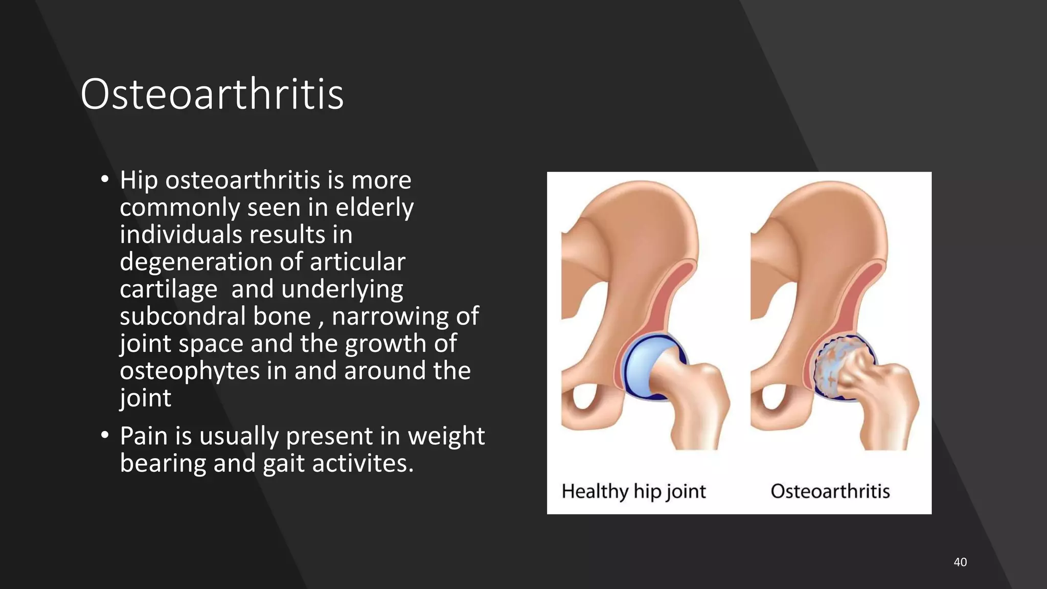 Hip Joint Biomechanics | PPTX