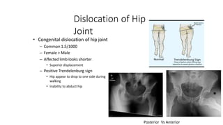 Dislocation of Hip
Joint
• Congenital dislocation of hip joint
– Common 1.5/1000
– Female > Male
– Affected limb looks shorter
• Superior displacement
– Positive Trendelenburg sign
• Hip appear to drop to one side during
walking
• Inability to abduct hip
Posterior Vs Anterior
 