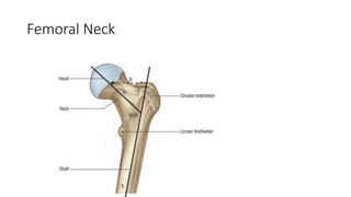Femoral Neck
 