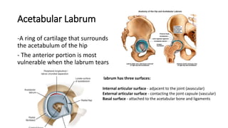 Acetabular Labrum
-A ring of cartilage that surrounds
the acetabulum of the hip
- The anterior portion is most
vulnerable when the labrum tears
labrum has three surfaces:
Internal articular surface - adjacent to the joint (avascular)
External articular surface - contacting the joint capsule (vascular)
Basal surface - attached to the acetabular bone and ligaments
 
