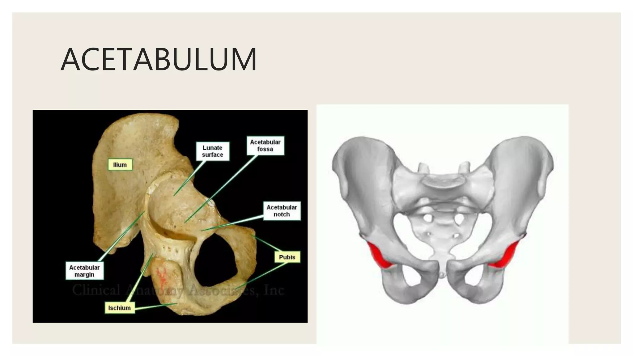 ACETABULUM
 