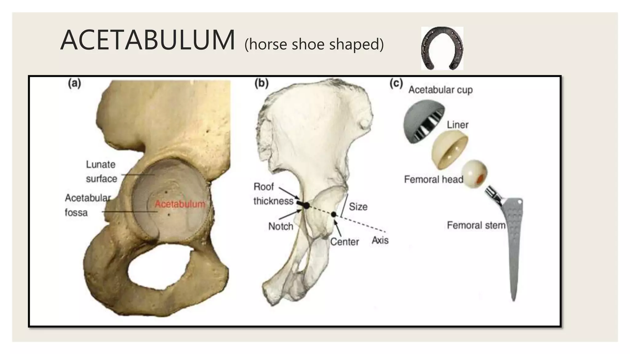ACETABULUM (horse shoe shaped)
 